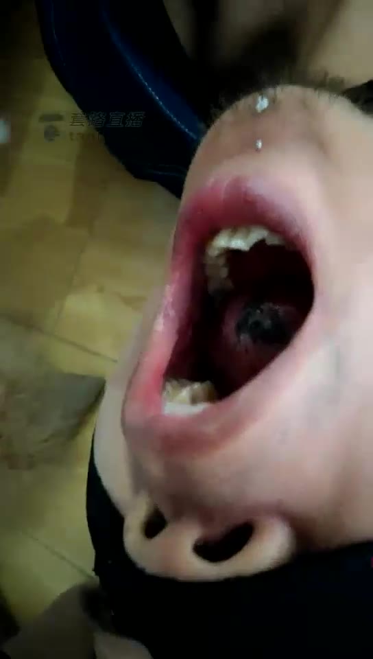 大佩佩 浓痰 烟灰 