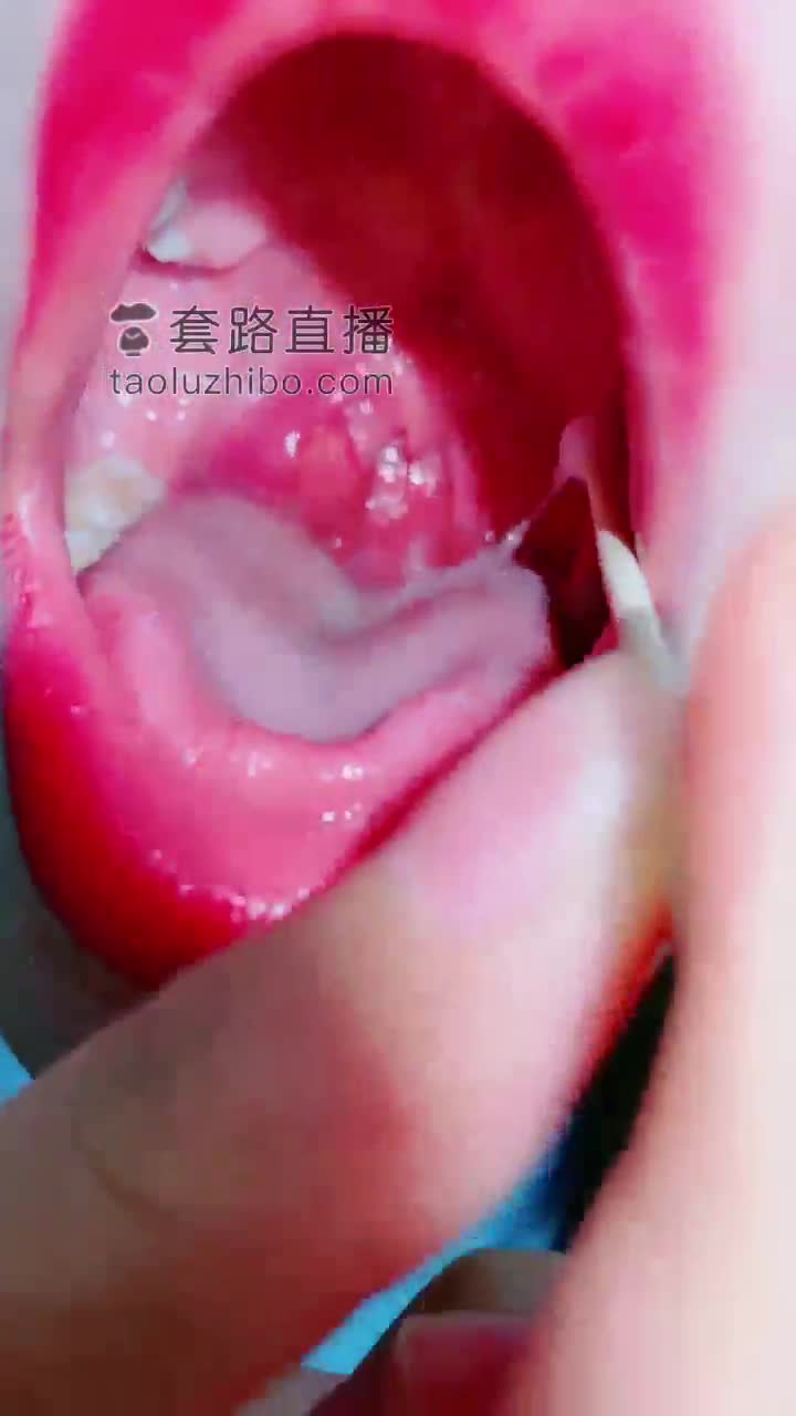 oral examination